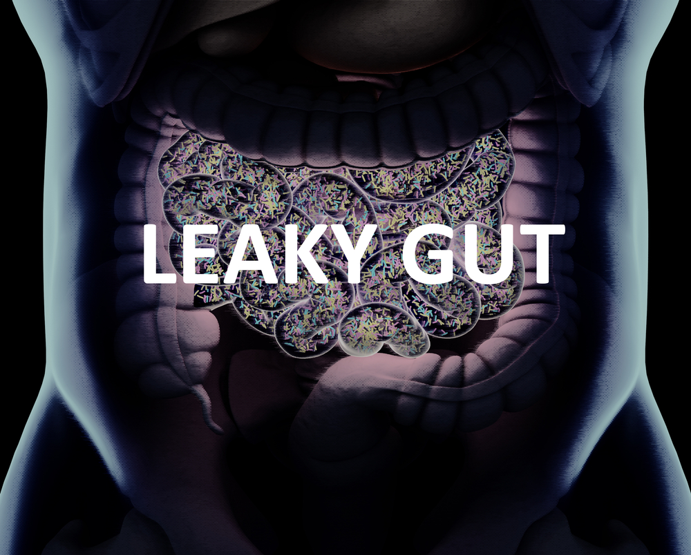What is a Leaky Gut?
